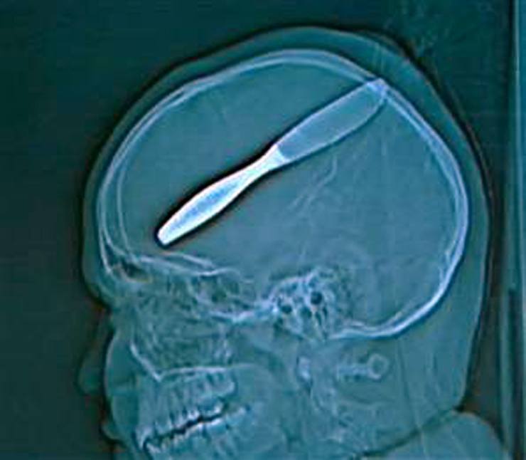 Нож для масла