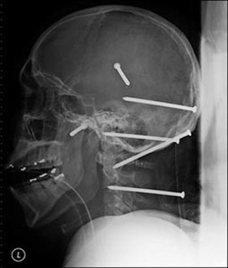 Пневматический молоток