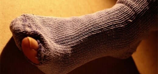 рваный носок